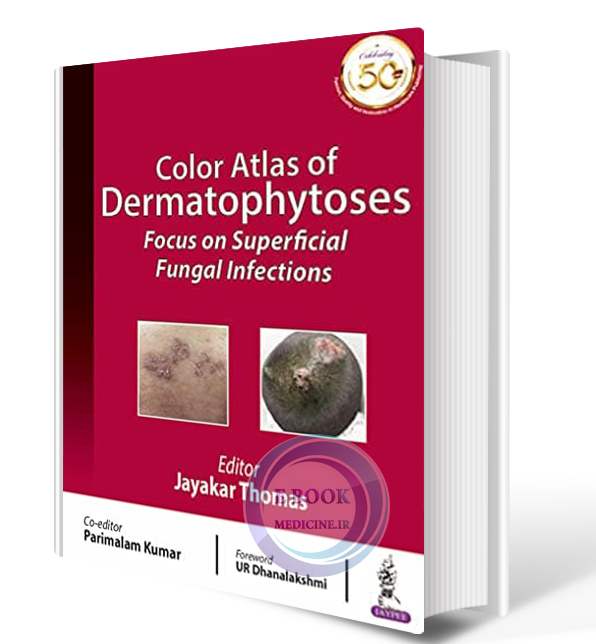 دانلود کتاب Color Atlas of Dermatophytoses: Focus on Superficial Fungal Infections 2021 (ORIGINAL PDF)